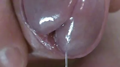 Pulled the anus with a cushion handle